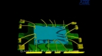 Hình CT SCAN – Electronic Chip
